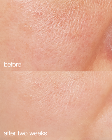 skin before and after and using biome boost cream collagen moisturizer