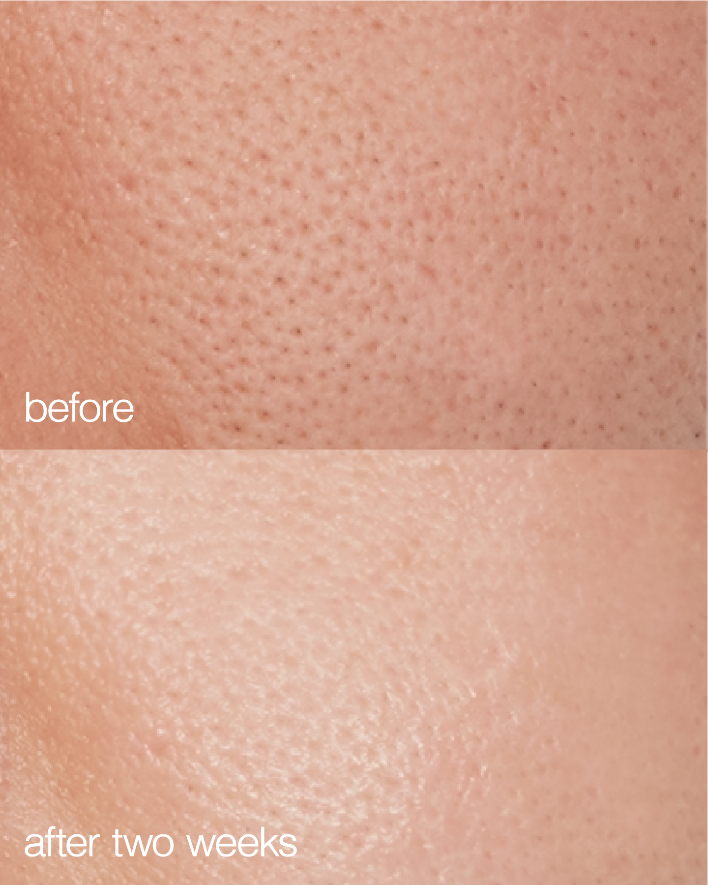  LAPCOS Biome Boost Cream Daily Moisturizer by LAPCOS - Default Title - Bonton