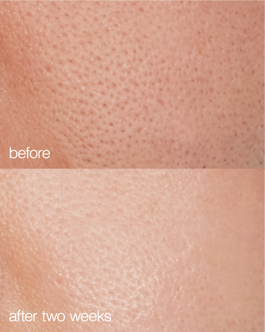 before + after skin use of LAPCOS collagen moisturizer