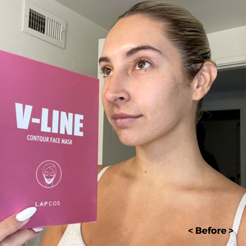 LAPCOS V-LINE CONTOUR CHIN MASK WITH COLLAGEN BEFORE
